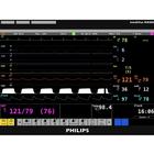 Simulação de tela para Monitor de Paciente Philips IntelliVue MX800 para REALITi 360, 8000974, Monitores