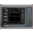 Hamilton T1® lélegeztetőgép képernyő-szimuláció a REALITi360 számára, 8001137, Betegmonitor Szimuláció