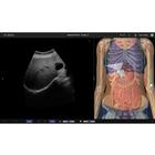 e Sono Abdominal Ultrason &ndash; Bireysel Lisans, 8001269, e Sono Kursları Bireysel Lisanslar (Small)