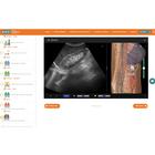 POCUS E-Sim Complete da GUSI & e Sono &ndash; Licen&ccedil;a individual, 8001276, Licen&ccedil;as Individuais Dos Cursos e Sono (Small)