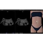e Sono Gynecological & Obstetric (OB/GYN) basic ultrasound course &ndash; Multiuser License, 8001278, Online Ultrasound POCUS Courses (Small)