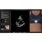 
	e Sono EMS POCUS Basic Course - Online Ultrasound Simulation Training
	
	Single-user license, 8001418, e Sono Courses Individual Licenses (Small)