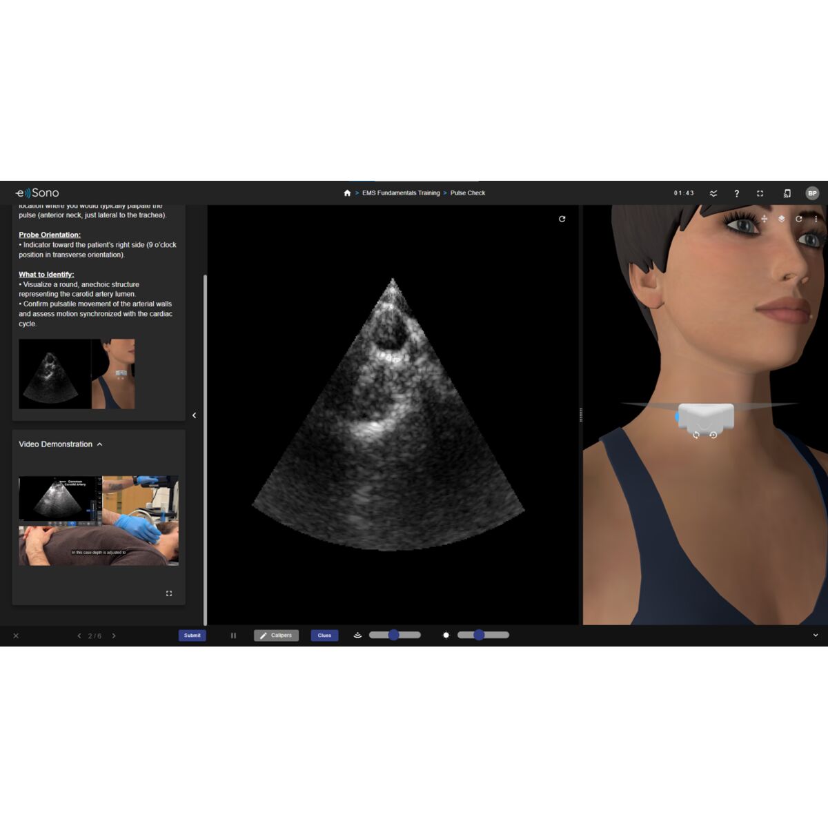 e Sono EMS POCUS Basic — Online Ultrasound Simulation Training for ...