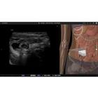 e Sono Sonographers Course - Single User License, 8001426, e Sono Courses Individual Licenses (Small)