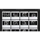 e Sono Clinical Essentials Library - Multiuser License&nbsp;, 8001452, Online Ultrasound POCUS Courses (Small)