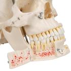 Deluxe Human Demonstration Dental Skull Model, 10 part, 1000059 [A27], Human Skull Models (Small)