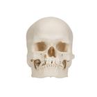 이상 소두 (小頭) 두개골 모형 Microcephalic Human Skull Model, 1000065 [A29/1], 두개골 모형