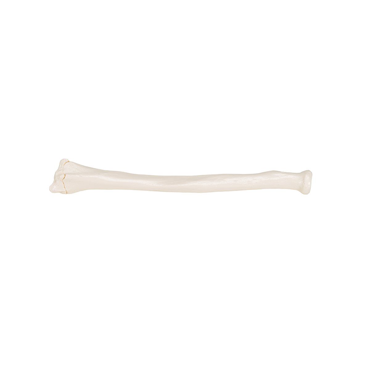 Human Radius Model - 3B Smart Anatomy - 1019374 - 3B Scientific - A45/3 ...