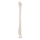 Human Radius Model, 1019374 [A45/3], Arm and Hand Skeleton Models (Small)