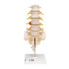Human Lumbar Spinal Column Model with Dorso-Lateral Prolapsed Intervertebral Disc - 3B Smart Anatomy, 1000150 [A76/5], Vertebra Models