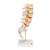 Colonna vertebrale lombare con ernia del disco dorsolaterale - 3B Smart Anatomy, 1000150 [A76/5], Modelli di vertebre (Small)