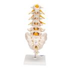 Human Lumbar Spinal Column Model with Dorso-Lateral Prolapsed Intervertebral Disc, 1000150 [A76/5], Vertebra Models (Small)