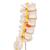 Human Lumbar Spinal Column Model with Dorso-Lateral Prolapsed Intervertebral Disc - 3B Smart Anatomy, 1000150 [A76/5], Vertebra Models (Small)