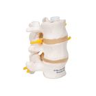 3 Human Lumbar Vertebrae, Flexibly Mounted, 1000151 [A76/8], Vertebra Models (Small)