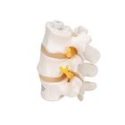 3 Lendenwirbel Modelle, elastisch montiert, 1000151 [A76/8], Wirbelmodelle (Small)