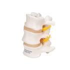 Tres discos vertebrales, montados flexibles, 1000151 [A76/8], Modelos de v&eacute;rtebras (Small)