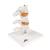 Deluxe Human Osteoporosis Model (3 Vertebrae with Discs ), Removable on Stand - 3B Smart Anatomy, 1000153 [A78], Arthritis and Osteoporosis Education (Small)