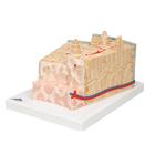 3B MICROanatomy Human Bone Structure, 80 times enlarged, 1000154 [A79], Microanatomy Models  (Small)