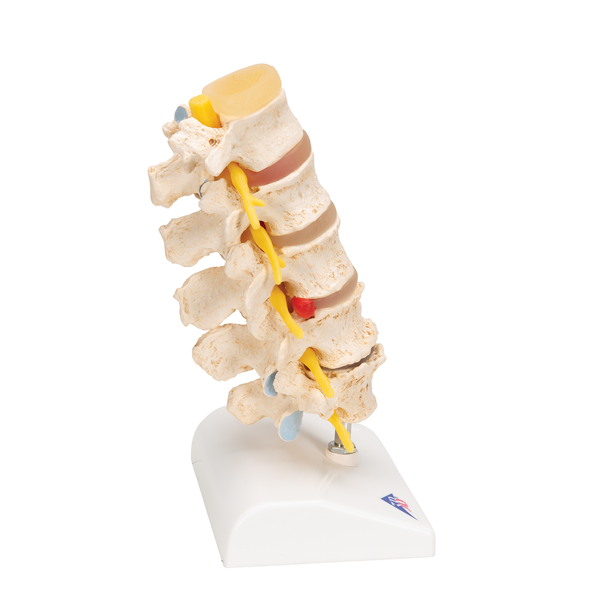 13.4 Height 3B Scientific A76/5 Lumbar Spinal Column with Dorso-Lateral Prolapsed Intervertebral Disc