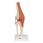 Funktionales Kniegelenkmodell "Luxus" mit Bändern - 3B Smart Anatomy, 1000164 [A82/1], Gelenkmodelle