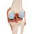 Functional Human Knee Joint Model with Ligaments & Marked Cartilage - 3B Smart Anatomy, 1000164 [A82/1], Joint Models (Small)
