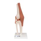 무릎 관절(슬관절) 모형 Functional Knee Joint, 1000163 [A82], 관절 모형