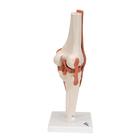 Funkcion&aacute;lis t&eacute;rd&iacute;z&uuml;let, 1000163 [A82], &Iacute;z&uuml;leti modellek (Small)
