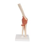 Functional Human Elbow Joint Model with Ligaments & Marked Cartilage, 1000166 [A83/1], Joint Models (Small)