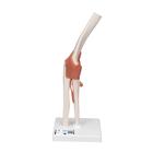 팔꿈치 관절(주관절)모형
Functional Elbow Joint, 1000165 [A83], 관절 모형