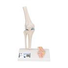 관절 단면이 포함된 소형(미니) 무릎 관절(슬관절) 모형 Mini Human Knee Joint Model with Cross Section, 1000170 [A85/1], 관절 모형