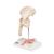 Fracture du fémur et usure de l'articulation de la hanche - 3B Smart Anatomy, 1000175 [A88], Éducation Arthrite et Ostéoporose (Small)