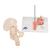 Combcsonttörés és csípőízületi gyulladás - 3B Smart Anatomy, 1000175 [A88], Ízületi modellek (Small)