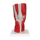 무릎관절(슬관절) 근육 모형 12파트 Knee Joint with Removable Muscles, 12 part - 3B Smart Anatomy, 1000178 [A882], 근육 모델