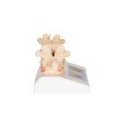 Osteoporosis Didactic Model, 1000182 [A95], Human Spine Models (Small)