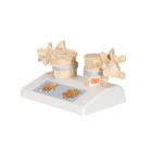 Osteoporosis Didactic Model, 1000182 [A95], Human Spine Models (Small)