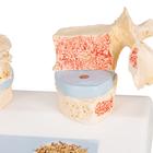 Osteoporosis Didactic Model, 1000182 [A95], Human Spine Models (Small)