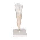 Lower Canine Human Tooth Model, 2 part, 1000241 [D10/2], Dental Models (Small)