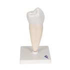 Primer molar inferior de ra&iacute;z sencilla, 1000242 [D10/3], Modelos dentales (Small)