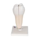 Lower Twin-Root Molar with Cavities Human Tooth Model, 2 part, 1000243 [D10/4], Dental Models (Small)