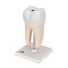 Lower Twin-Root Molar with Cavities Human Tooth Model, 2 part, 1000243 [D10/4], Dental Models (Small)
