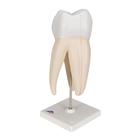 Upper Triple-Root Molar Human Tooth Model, 3 part, 1017580 [D10/5], Dental Models (Small)