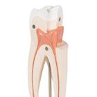 Upper Triple-Root Molar Human Tooth Model, 3 part, 1017580 [D10/5], Dental Models (Small)