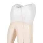 Upper Triple-Root Molar Human Tooth Model, 3 part, 1017580 [D10/5], Dental Models (Small)