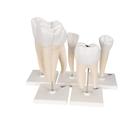 Human Tooth Models Set "Classic Series", 5 Models, 1017588 [D10], Dental Models (Small)