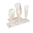 Human Tooth Models Set "Classic Series", 5 Models, 1017588 [D10], Dental Models (Small)