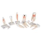 Serie de modelos dentales , 5 modelos, 1017588 [D10], Modelos dentales (Small)