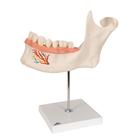 Half Lower Human Jaw Model, 3 times Full-Size, 6 part, 1000249 [D25], Dental Models (Small)