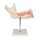 Half Lower Human Jaw Model, 3 times Full-Size, 6 part, 1000249 [D25], Dental Models (Small)