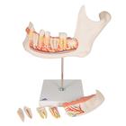 Half Lower Human Jaw Model, 3 times Full-Size, 6 part, 1000249 [D25], Dental Models (Small)