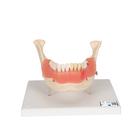 Dental Disease Model, Magnified 2 times, 21 parts - 3B Smart Anatomy, 1000016 [D26], Dental Models
